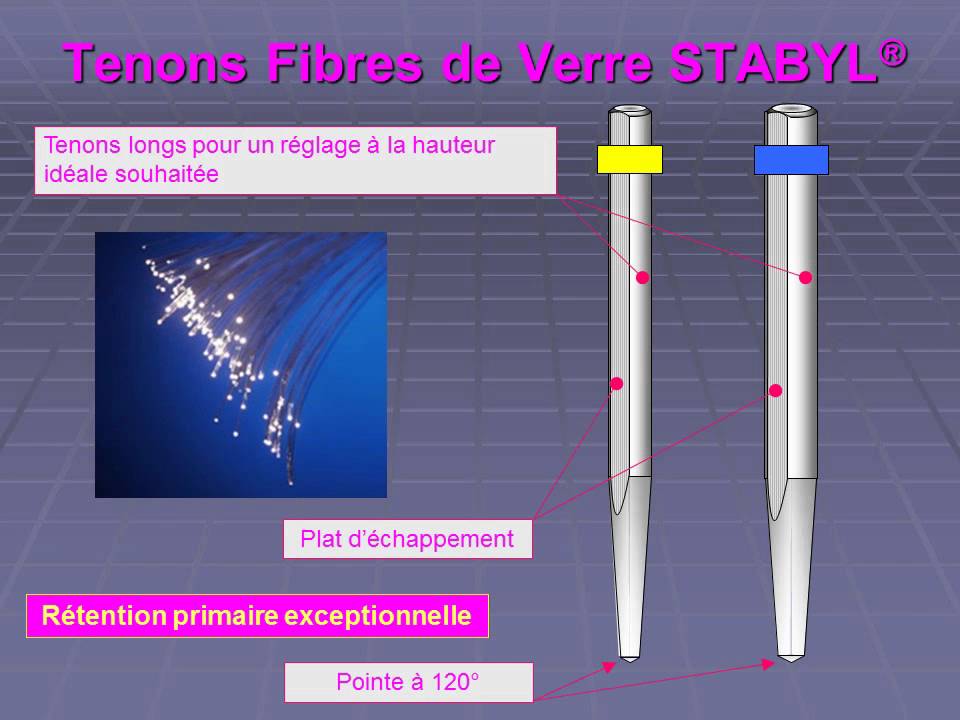 Présentation tenons Stabyl