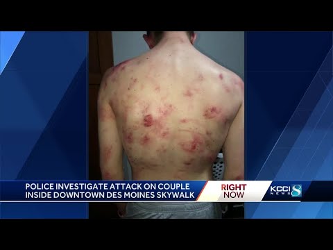 Police looking for group of teens after brutal skywalk assault