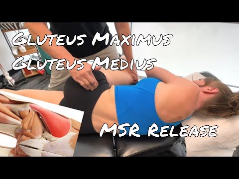Gluteus Maximus & Medius - Motion Specific Release