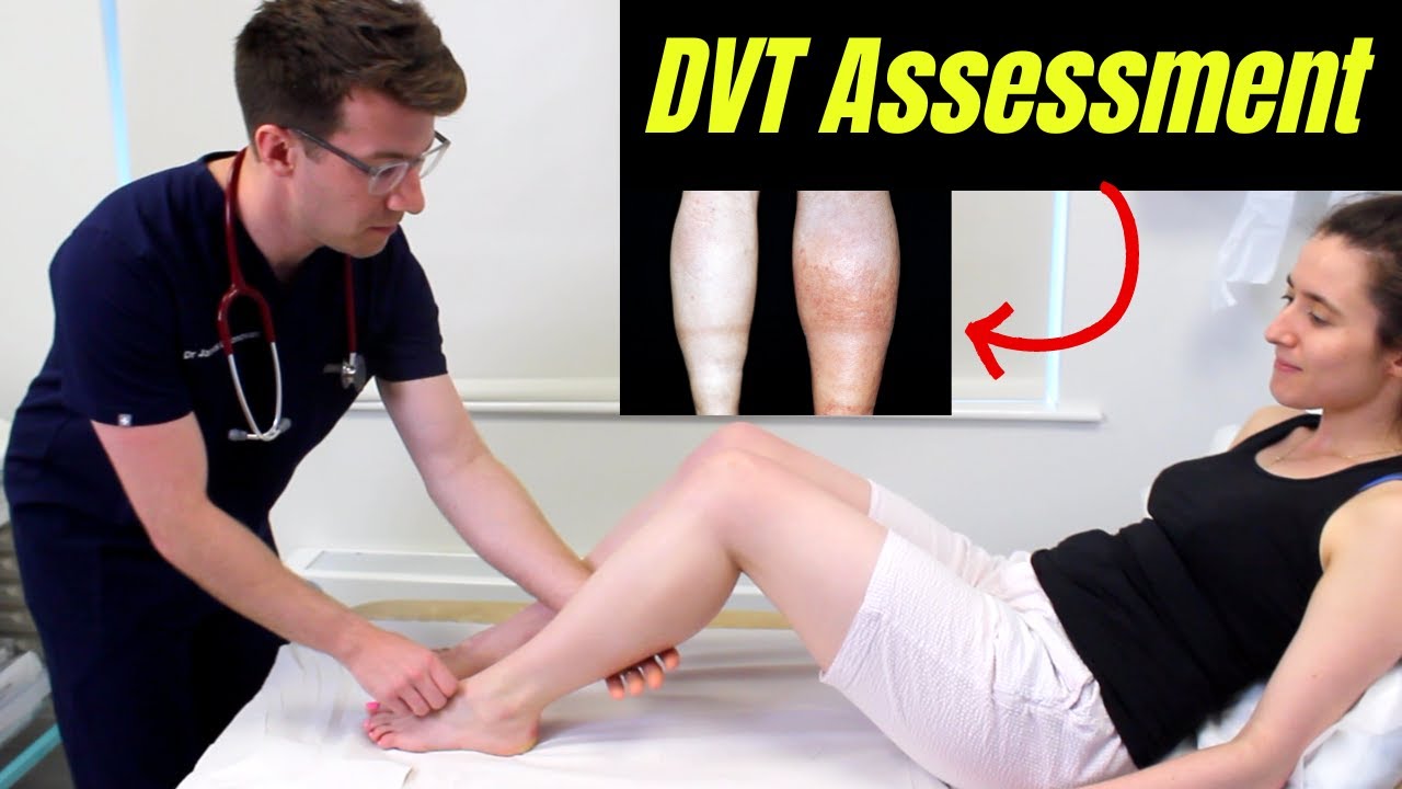 Deep Vein Thrombosis (DVT) OSCE Clinical Examination | Plus DVT risk factors, diagnosis & treatment