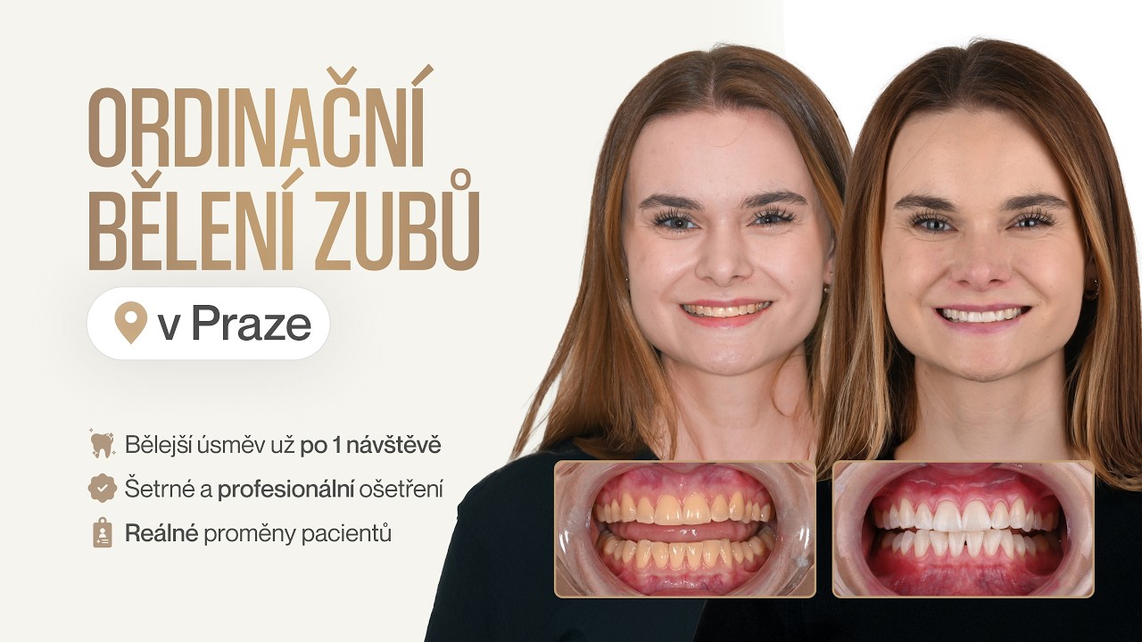 Úsměv, který přitahuje pozornost. 