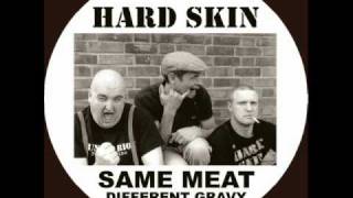Hard Skin -  Beers and Fags