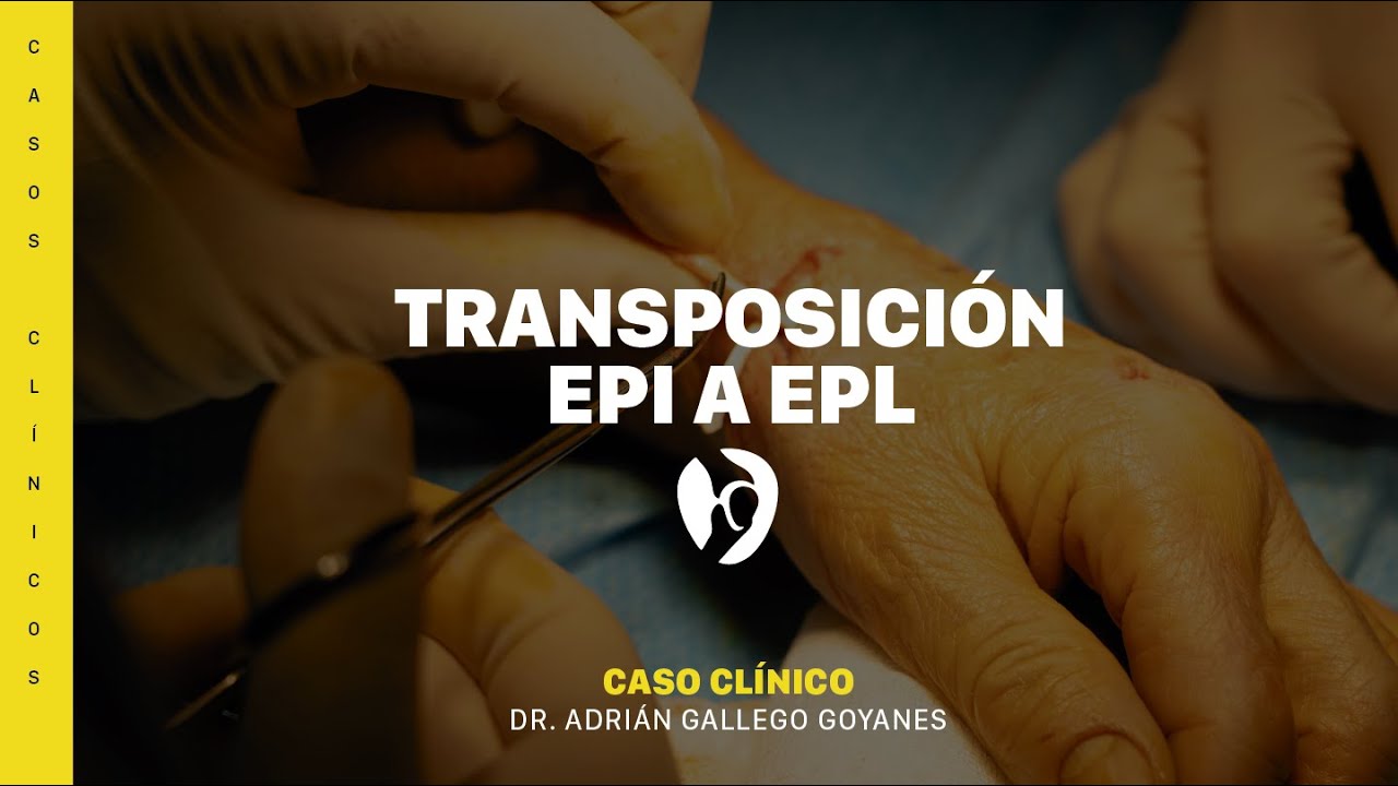 Adrián Gallego Goyanes-35