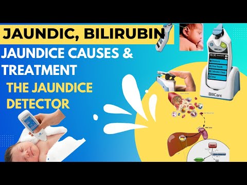 baby incubator incubator machine baby incubator working principle baby incubator uses