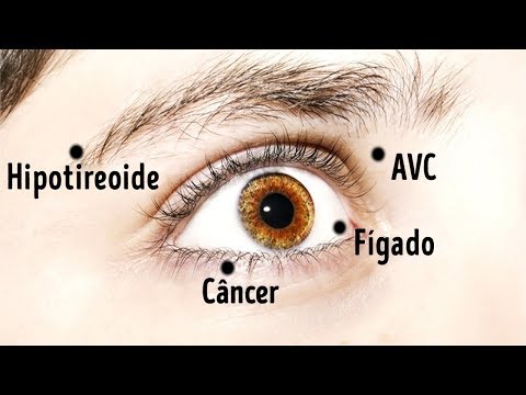 Os Olhos e a sua saúde