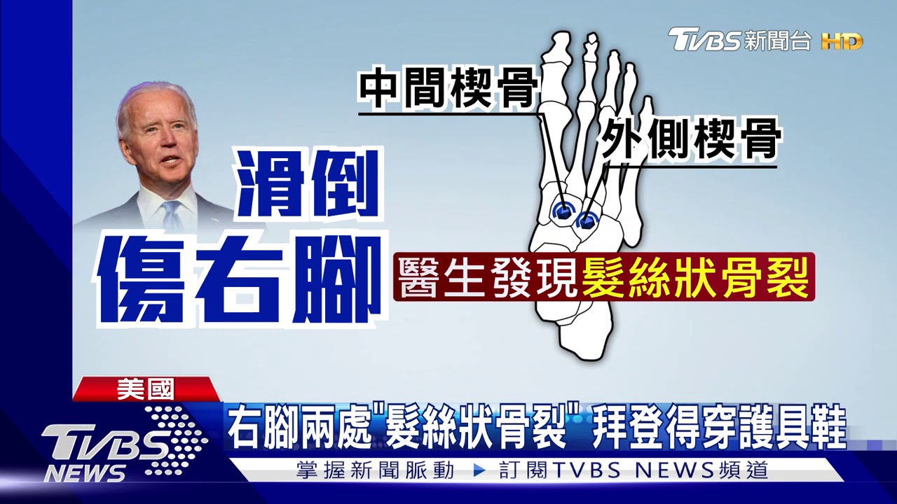 拜登滑倒右腳骨裂 川普推特送暖祝康復