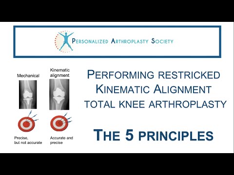 The 5 principles to perform restricted kinematic alignment total knee arthroplasty