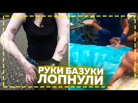 Руки базуки у Елены Малышевой / Кирилл Терешин умирает
