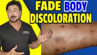 You Can Fade Dark Spots Faster Than You'd Expect Here's Why!