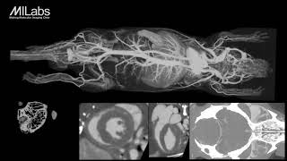 Unprecedented in vivo spatial and temporal resolution with high speed and low dose X-ray CT