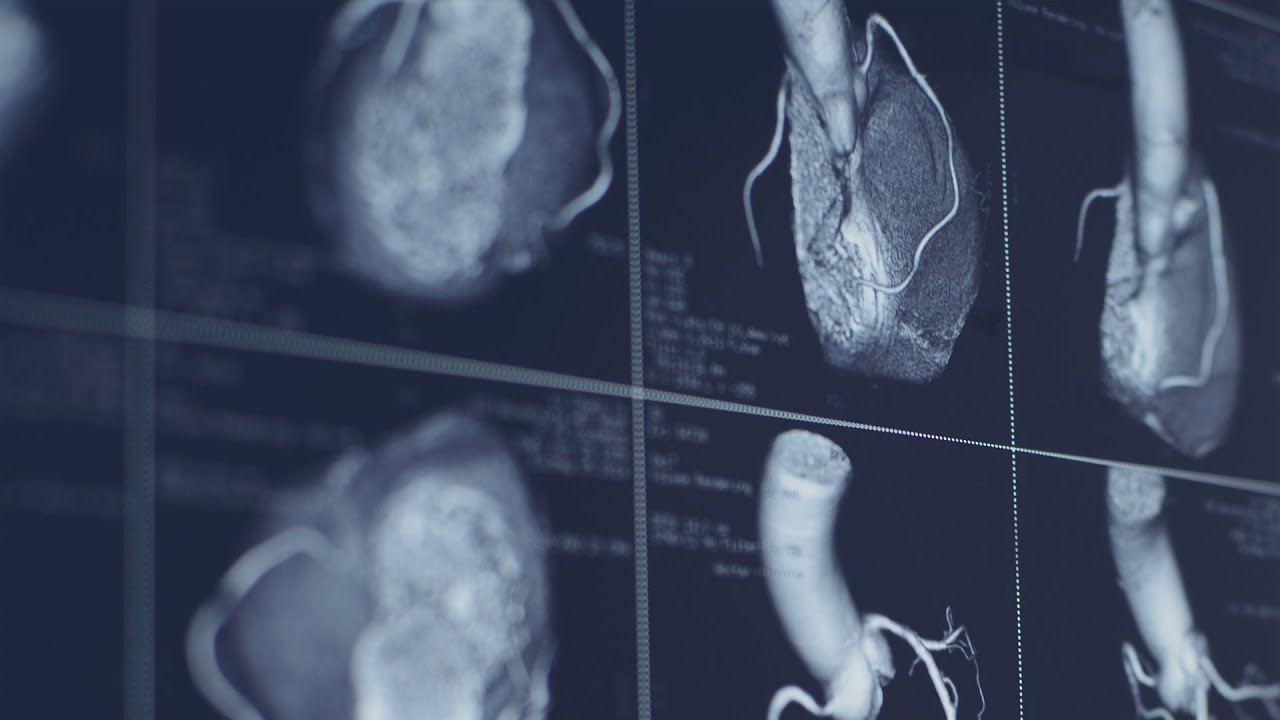 Royal Papworth Hosptital   A moving story   Trailer