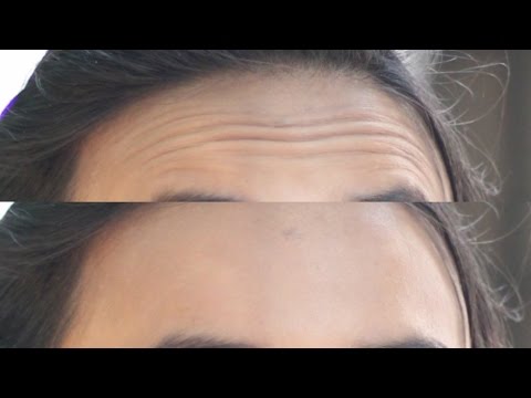 Kung paano magluto brown rice diyeta Kung paano mawalan ng timbang sa pamamagitan ng tumatakbo