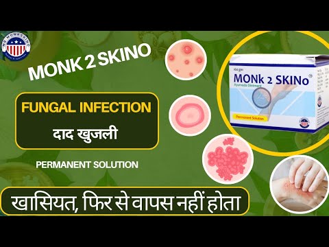 Monk 2 skino, 160 gm