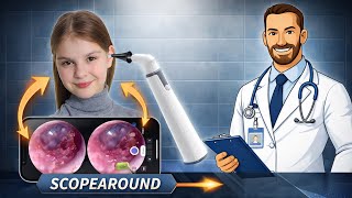 Otoscope Recommendations for ScopeAround