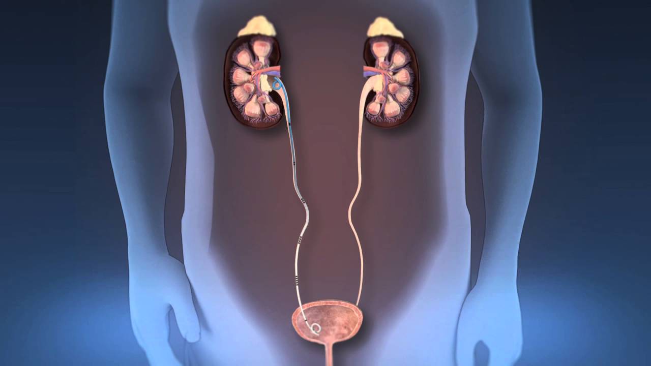 Edgar Linden Castro-17