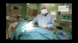 Rizólisis: tratamiento de radiofrecuencia para dolencias articulares