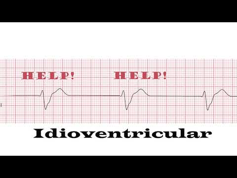 If EKGs were songs 2.0