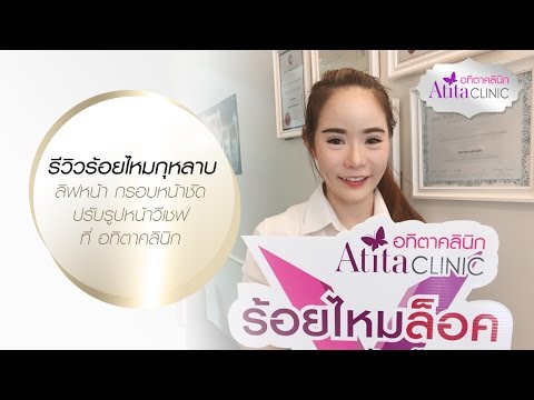 ร้อยไหม หน้าเรียว