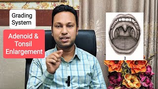 How to Grade Adenoid & Tonsillar Enlargement