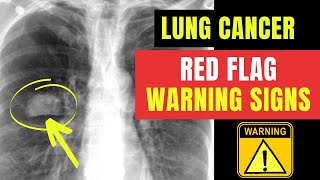 How to spot RED FLAG warning signs & symptoms of LUNG CANCER... Doctor O