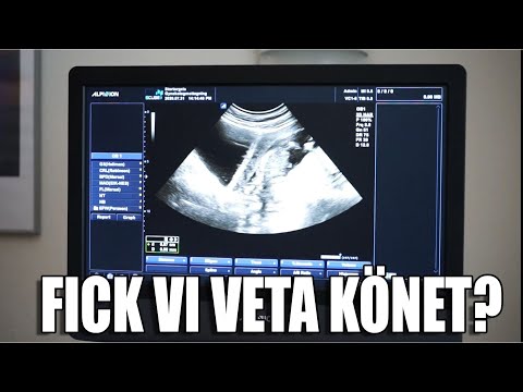 FÖRSTA ULTRALJUDET | vlogg