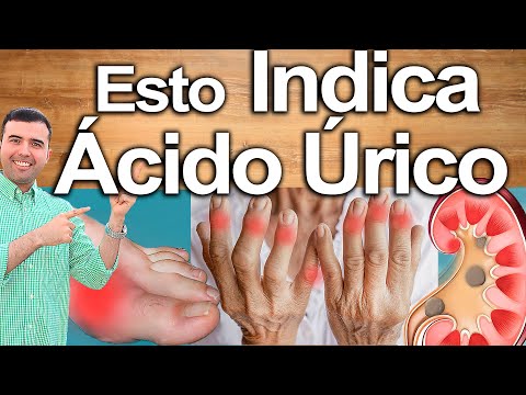 Cómo Saber Si Tu Ácido Úrico Está Alto - No Ignores Los Signos Y Síntomas De Acido Urico Elevado