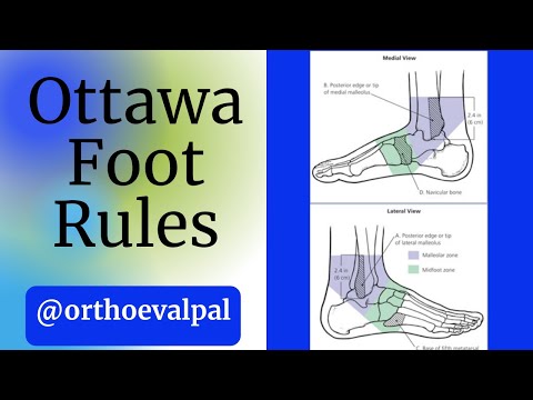 Metatarsalgia and Morton s Neuroma Evaluation and Treatment