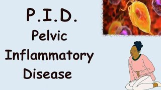 Basic Care for Pelvic Inflammatory Disease | PID Treatment