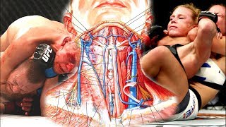 The Effects of Chokes on the Body  Blood Choke