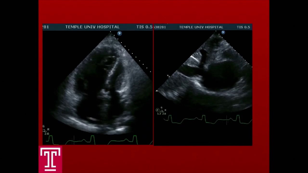 Echo 2025: What Tomorrow’s Echo Lab Will Look Like