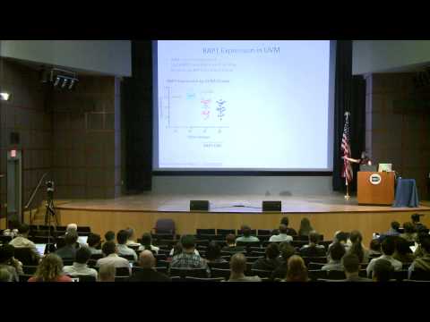 Somatic Copy Number Alterations and Aneuploidy Events in Uveal Melanoma -Juliann Shih
