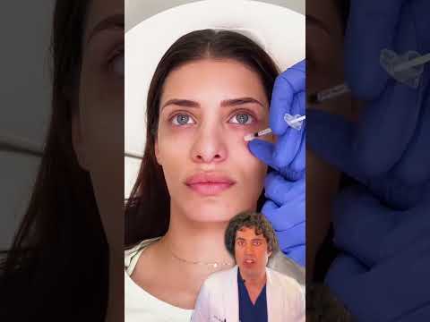 One of the BEST Treatments for Sunken Under Eyes and Dark Circles (INSTANT Results!)