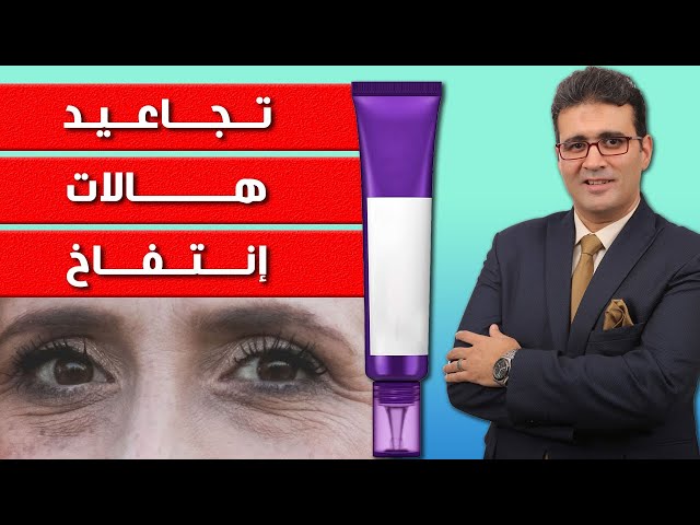 كريم ريتينول المركز للعناية بمحيط العين من سوم باي مي - 30 مل