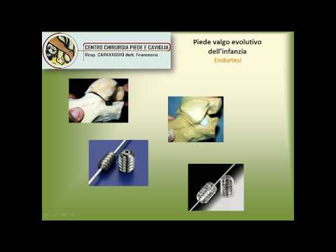Punto di osteocondrosi cervicale girudoterapiya Ð²Ñ € Ð ° Ñ ‡ Ð ± оР± Ñ € Ð¾Ð²Ñ ÐºÐ¸Ð¹ Ð »ÐμÑ ‡ ÐμниÐμ Ð¿Ð¾Ð Ð²Ð¾Ð½Ð¾Ñ ‡ · ° никÐ