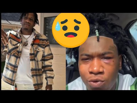 OTS Lil Pap Warns 4KT Members That Allowed NBA Ben10 Eye Tint To Happen 