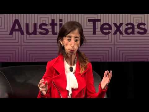 Sample video for Lizzie Velasquez