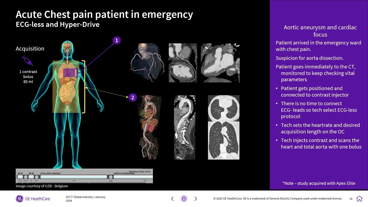 SCCT Global 2026: Cutting edge CT technologies