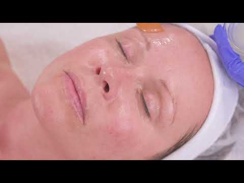 Nimue Bioactive treatment demonstration video.