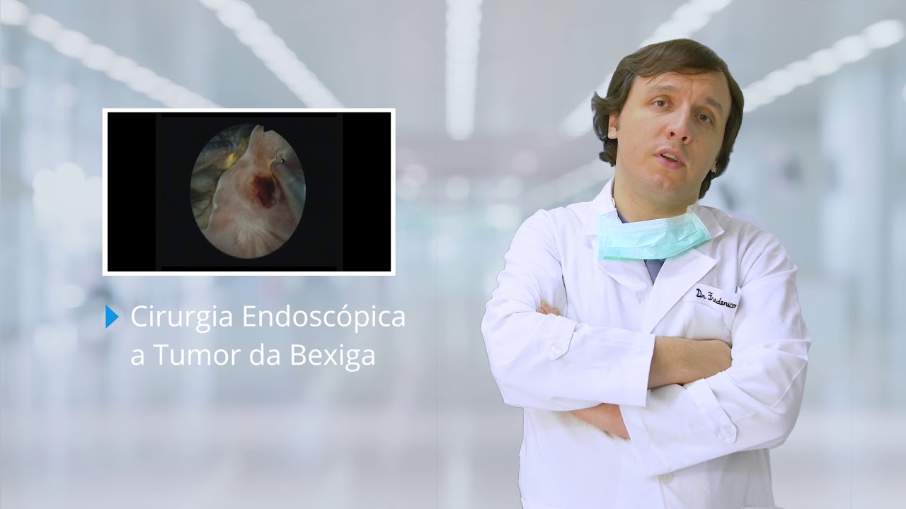 Neoplasia da Bexiga - Dr. Frederico Branco