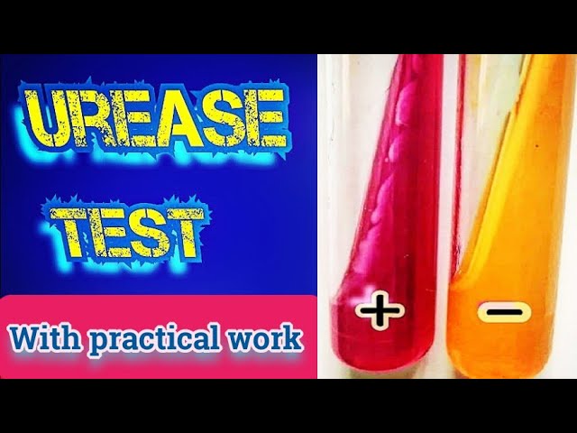 Understanding the Urease Test in Microbiology | Galaxy.ai