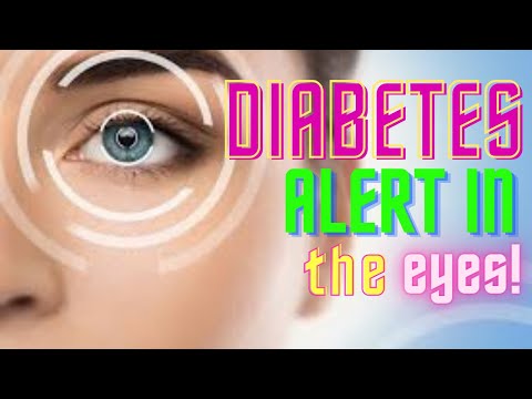 The Warning Signs Of High Blood Sugar In Your Eyes