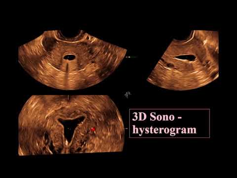 Icd 10 az uvulai pikkelyes papilloma esetén - paperweb.hu