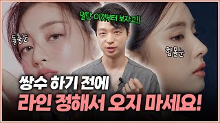 연예인 쌍꺼풀 무작정 따라했다가 망하는 가장 큰 이유!