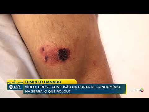 Vídeo: tiros e confusão na porta de condomínio na Serra! O que rolou?