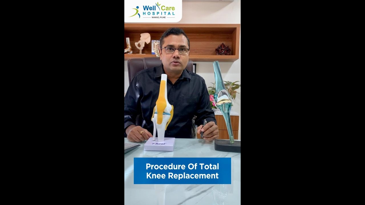 Total knee replacement