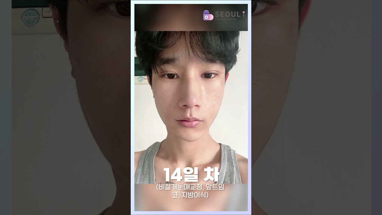 멸치에서 미대오빠된 후기 #shorts