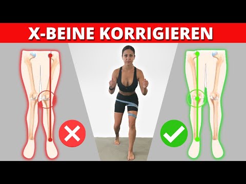 #2 X BEINE KORRIGIEREN mit dieser Übung!