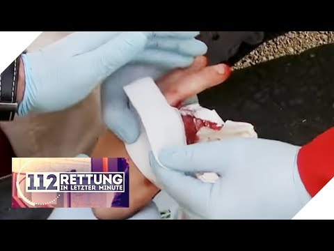 Jede Sekunde zählt: Wo ist der verlorene Finger? | 112 - Rettung in letzter Minute | SAT.1 TV