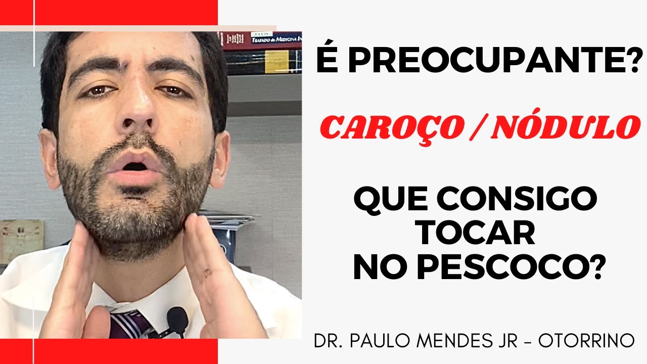 Vou te contar um segredo sobre NÓDULOS OU ÍNGUAS no pescoço