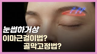 첫 쌍꺼풀 수술, 실패 없이 성공하려면?